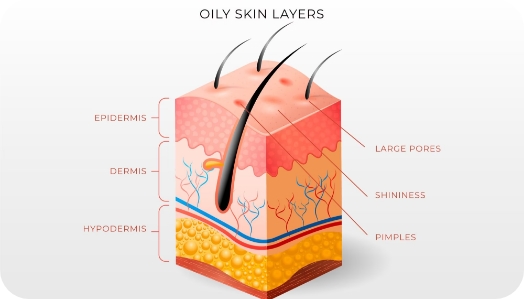 Detalle de las capas de la piel